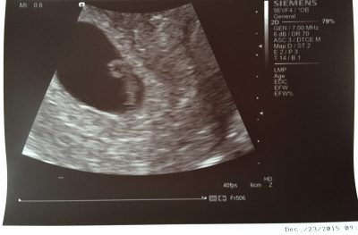 It's time to talk about miscarriage
